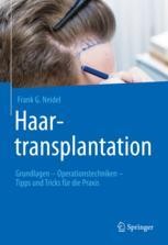 cover: Haartransplantation